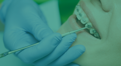 Orthodontie tandarts Zijdelwaard